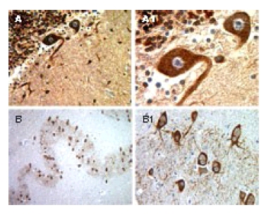 Formalin fixed, paraffin embedded tissue sections of normal human brain stained for BAR expression using ab47127 at 1/2000. A, A1: Cerebellum. B, B1: Medulla. A1 and B1 are higher magnifications of A and B, respectively."