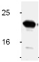 Western blot analysis of Bid in Jurkat cells treated with anti-Fas for 6 hours.