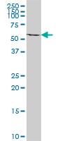 Anti-ACAD9 antibody (ab72655) at 1/500 dilution + Human liver tissue lysate at 25 µgSecondaryGoat Anti-Mouse IgG (H&L)-HRP Conjugate at 1/2500 dilution