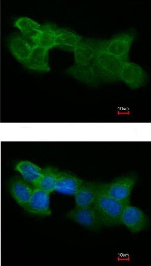 Immunofluorescent analysis of paraformaldehyde-fixed A431 cells labeling Bif with ab154236 at 1/200 dilution. Lower panel merged with DNA probe.