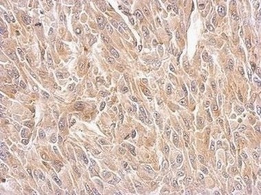 Immunohistochemical analysis of paraffin-embedded U87 xenograft tissue labeling Bif with ab154236 at 1/500 dilution.