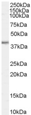 Anti-Biglycan antibody (ab58562) at 0.1 µg/ml + Rat Skin lysate (35µg protein in RIPA buffer).