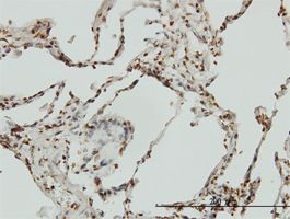 Bik antibody (ab54862) used in immunohistochemistry at 3ug/ml on formalin fixed and paraffin embedded human lung.