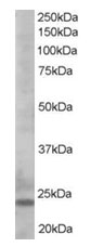 Anti-Bim antibody (ab17031) at 0.5 µg/ml + Cell lysates prepared from Human K562 cells at 35 µg