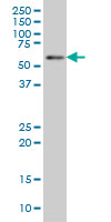 BIN1 antibody (ab54764) at 1ug/lane + HeLa cell lysate at 25ug/lane.