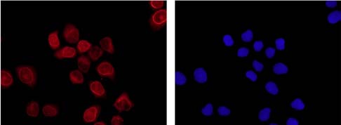 Immunofluorescent analysis of HeLa cells labeling BIN1 with ab182562 at 1/250 and Goat anti rabbit IgG(Alexa Fluor®555) at 1/200. Cells were fixed with -20℃ Acetone. Image at the right stained with DAPI.