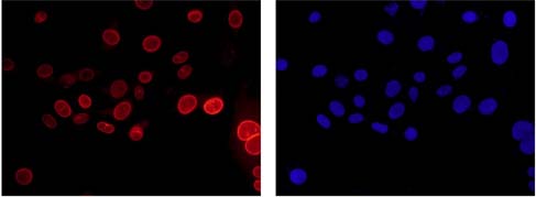 Immunofluorescent analysis of U87-MG cells labeling BIN1 with ab182562 at 1/250 and Goat anti rabbit IgG(Alexa Fluor®555) at 1/200. Cells were fixed with 4% paraformaldehyde. Image at the right stained with DAPI.