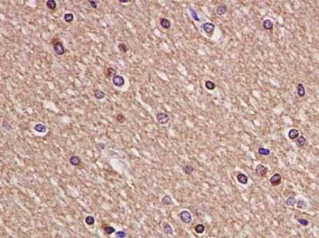 Immunohistochemical analysis of paraffin embedded Human brain tissue labeling BIN1 with ab182562 at 1/100.