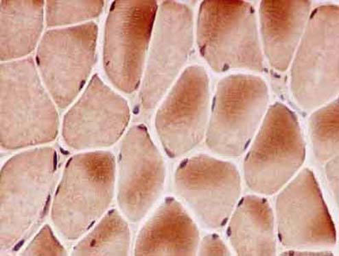 Immunohistochemical analysis of paraffin embedded Human skeletal muscle tissue labeling BIN1 with ab182562 at 1/100.