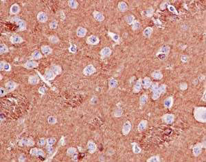 Immunohistochemical analysis of paraffin-embedded Mouse brain tissue labeling BIN1 with ab185950 at 1/100 dilution. Secondary ab: Ready to use HRP Polymer for Rabbit IgG. Counter stain: Hematoxylin.