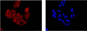 Immunofluorescent analysis of HeLa cells labeling BIN1 with ab185950 at 1/100 dilution. Secondary ab: Goat anti rabbit IgG (Alexa Fluor®555) at 1/200 dilution. Fixative: -20℃ Acetone. Counter stain: Dapi (blue).