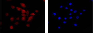Immunofluorescent analysis of U87-MG cells labeling BIN1 with ab185950 at 1/100 dilution. Secondary ab: Goat anti rabbit IgG (Alexa Fluor®555) at 1/200 dilution. Fixative: 4% paraformaldehyde. Counter stain: Dapi (blue)