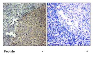 Immunohistochemistry analysis of paraffin-embedded human tonsil tissue using ab73706 at a 1:50 dilution.Left image un-treated.Right image treated with immunizing peptide.