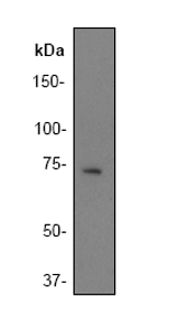 Anti-BLNK antibody [Y491] (ab32418) at 1/500 dilution + Raji cell lysate.Observed band size : 68 kDa (why is the actual band size different from the predicted?)