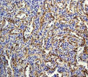 ab32418 at a 1:50 dilution staining BLNK in human spleen tissue using Immunohistochemistry, Paraffin Embedded Tissue.