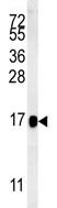 Anti-BLOC1S2 antibody (ab174929) at 1/1000 dilution + HepG2 cell lysate at 15 µg
