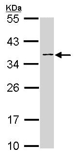 Anti-Blood Group Antigen Precursor antibody (ab97372) at 1/1000 dilution + HeLa whole cell lysate at 30 µg
