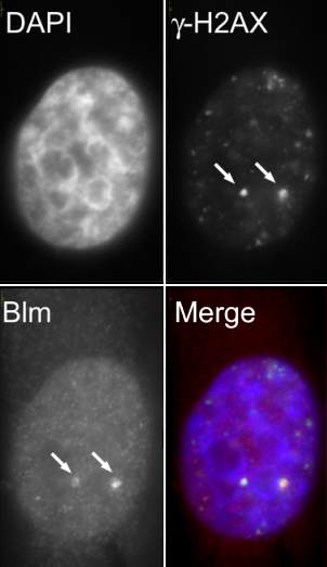 HeLa cells were treated with 15µM Bleomycin for 2 hours to generate DNA double stranded breaks (DSBs). Paraformaldehyde-fixed cells were co-immunofluorescently labelled with anti-gamma H2AX (DNA DSB marker) and anti-BLM (ab2179). ab 2179 was used at a concentration of 5µg/ml. Colocalization at the sites of DNA DSBs is identified by the arrows. In the final panel DAPI is pseudo-coloured blue, while anti-gamma H2AX and anti-Blm are green and red respectively.