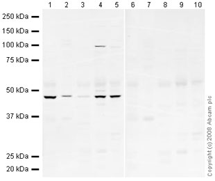 All lanes : Anti-BMP4 antibody (ab39973) at 1 µg/mlLane 1 : Brain (Human) Tissue Lysate - adult normal tissue (ab29466)Lane 2 : Brain (Mouse) Mouse Tissue Lysate Lane 3 : Liver (Human) Tissue Lysate - adult normal tissue (ab29889)Lane 4 : Heart (Human) Tissue Lysate - adult normal tissue (ab29431)Lane 5 : Skeletal Muscle (Human) Tissue Lysate - adult normal tissue (ab29330)Lane 6 : Brain (Human) Tissue Lysate - adult normal tissue (ab29466) with Human BMP4 peptide (ab40140) at 1 µg/mlLane 7 : Brain (Mouse) Mouse Tissue Lysate with Human BMP4 peptide (ab40140) at 1 µg/mlLane 8 : Liver (Human) Tissue Lysate - adult normal tissue (ab29889) with Human BMP4 peptide (ab40140) at 1 µg/mlLane 9 : Heart (Human) Tissue Lysate - adult normal tissue (ab29431) with Human BMP4 peptide (ab40140) at 1 µg/mlLane 10 : Skeletal Muscle (Human) Tissue Lysate - adult normal tissue (ab29330) with Human BMP4 peptide (ab40140) at 1 µg/mlLysates/proteins at 10 µg per lane.SecondaryIRDye 680 Conjugated Goat Anti