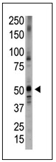 Anti-BMP5 antibody (ab38565) at 1/100 dilution + placenta tissue lysate