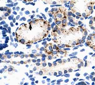 Immunohistochemistry (Formalin/PFA-fixed paraffin-embedded sections) analysis of human kidney tissue labelling BMP7 with ab56023 at 4-8µg/ml. Arrows indicate positively labelled epithelial cells of the renal tubule. Magnification: 400X.