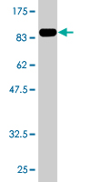 Anti-BMPR1A antibody (ab77022) at 5 µg/ml + recombinant full length BMPR1A protein (the immunogen) at 0.2 µgSecondaryGoat Anti-Mouse IgG (H&L)-HRP Conjugate at 1/5000 dilution