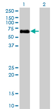 All lanes : Anti-BMPR1A antibody (ab77022) at 5 µg/mlLane 1 : BMPR1A transfected 293T cell lysateLane 2 : Non transfected 293T cell lysateLysates/proteins at 25 µg per lane.SecondaryGoat Anti-Mouse IgG (H&L)-HRP Conjugate at 1/2500 dilution