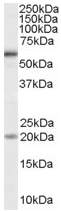 Anti-BMPR1A antibody (ab52023) at 1 µg/ml + HeLa cell lysate (35µg protein in RIPA buffer).