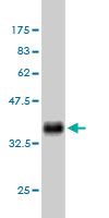 Western blot against tagged recombinant protein immunogen using ab54909 BMPR1B antibody at 1ug/ml.
