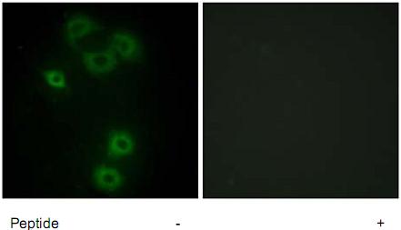 Left panel: immunofluorescence analysis of A549 cells, using 1/550-1/1000 ab73887. Right panel: same, after pre-incubation with the immunizing peptide.