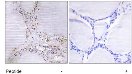 Left panel: immunohistochemistry analysis of paraffin-embedded human thyroid gland tissue using 1/50-1/100 ab73887; Right panel: same, after pre-incubation with the immunizing peptide.