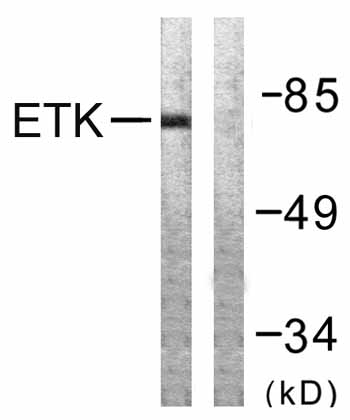 All lanes : Anti-BMX antibody (ab59360) at 1/500 dilutionLane 1 : Extracts from A549 cells with no immunizing peptideLane 2 : Extracts from A549 cells with immunizing peptideObserved band size : 78 kDa (why is the actual band size different from the predicted?)