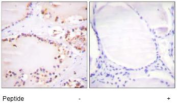ab59360, at a 1/50 dilution, staining human BMX in thyroid gland, using Immunohistochemistry, Paraffin embedded tissue, in the absence of the immunizing peptide (left image) and in the presence of the immunizing peptide (right image).