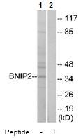 All lanes : Anti-BNIP2 antibody (ab74820) at 1/500 dilutionLane 1 : extracts from Jurkat cellsLane 2 : extracts from Jurkat cells with immunizing peptide at 10 µgLysates/proteins at 30 µg per lane.