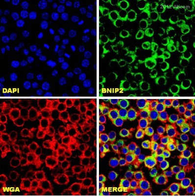 ab74820 staining BNIP2 (green) in Mouse RAW 264.7 cells by ICC (Immunocytochemistry). Cells were fixed with paraformaldehyde, permeabilized in 0.1% Triton X-100 in 2% BSA for 15 minutes and blocked with 2% BSA for 1 hour at 22°C. Samples were incubated with primary antibody (1/250 in PBS + 2% BSA) for 16 hours at 4°C. An Alexa Fluor®488-conjugated Chicken anti-rabbit IgG polyclonal (H&L) (1/750) was used as the secondary antibody. WGA (red) = Wheat Germ AgglutininSee Abreview