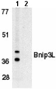 All lanes : Anti-BNIP3L antibody (ab8399) at 1 µg/mlLane 1 : K562 whole cell lysate with absence of immunogenic peptideLane 2 : K562 whole cell lysate with presence of immunogenic peptide