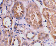 ab8399 at 2µg/ml staining BNIP3L in human kidney tissue by IHC 