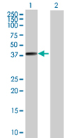 All lanes : Anti-BNIPL antibody (ab66975) at 1/500 dilutionLane 1 : BNIPL transfected 293T cell lysateLane 2 : Non-transfected 293T cell lysateLysates/proteins at 25 µg per lane.SecondaryGoat Anti-Mouse IgG (H&L)-HRP Conjugate at 1/2500 dilution