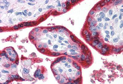 Immunohistochemical analysis of formalin fixed, paraffin embedded Human placenta tissue labelling Bombesin Receptor 3 with ab140711 at 8 µg/ml.