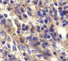 ab8023 at 20µg/ml staining Bonzo in human spleen cells by IHC