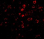 Immunofluorescence of Bora in Mouse Brain cells using ab106376 at 20 ug/ml.