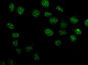 Immunofluorescent analysis of HeLa cells (-20℃ Acetone-fixed) labeling Bora with ab182149 at 1/250 dilution followed by Goat anti rabbit IgG (Alexa Fluor® 488) secondary at 1/200 diution.