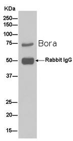 Western blot analysis of immunoprecipitation pellet from HeLa cell lysate immunoprecipitated using ab182149 at 1/40 dilution.Secondary: Goat Anti-Rabbit IgG, (H+L), Peroxidase conjugated at 1/1000 dilution.