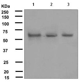 All lanes : Anti-Bora antibody [EPR4456] (ab108359) at 1/1000 dilutionLane 1 : fetal brain lysateLane 2 : SH-SY5Y lysateLane 3 : Y79 lysateLysates/proteins at 10 µg per lane.