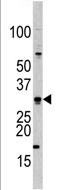 Anti-Borealin/CDCA8 antibody (ab70910) at 1/100 dilution + HL60 cell line lysates at 35 µg