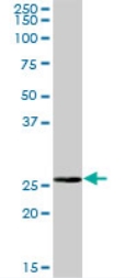 Anti-BPHL antibody (ab72851) at 1/500 dilution + human liver lysate at 25 µgSecondaryGoat Anti-Mouse IgG (H&L)-HRP conjugate at 1/2500 dilution