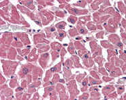 ab106149 at 3.75µg/ml staining BPOZ in Human heart by Immunohistochemistry, Formalin-fixed, Paraffin-embedded tissue followed by biotinylated anti-goat IgG secondary antibody, alkaline phosphatase-streptavidin and chromogen.