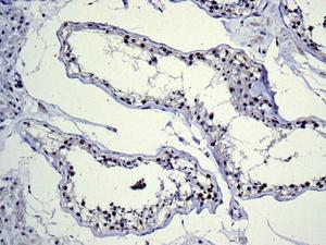 Immunohistochemical analysis of paraffin-embedded Human testis tissue labeling BRD2 with ab139690 at 1/250 dilution.