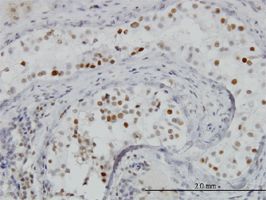 BRD3 antibody (ab56342) used in immunohistochemistry at 3ug/ml on formalin fixed and paraffin embedded human testis.