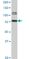 BRD3 antibody (ab56342) at 1ug/lane + HeLa cell lysate at 25ug/lane.